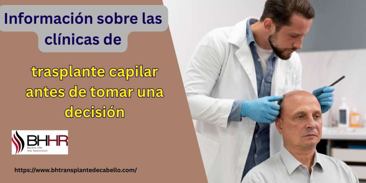 Información sobre las clínicas de trasplante capilar antes de tomar una decisión