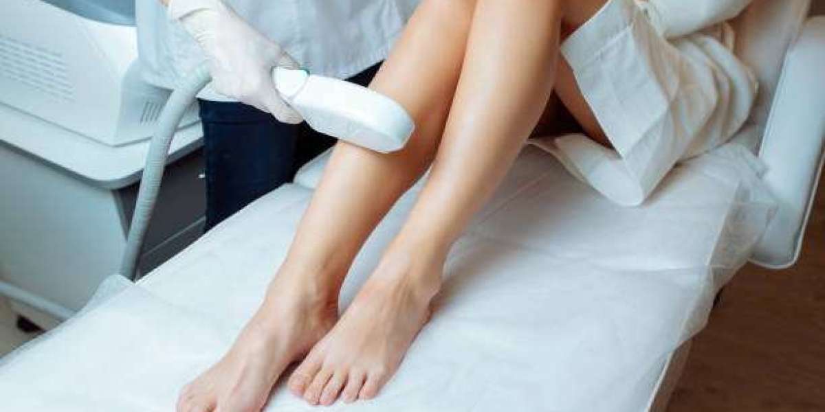 Enhancing Laser Hair Removal with Pre-Treatment Habits