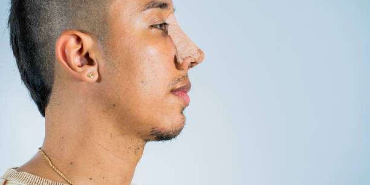 Article Picture