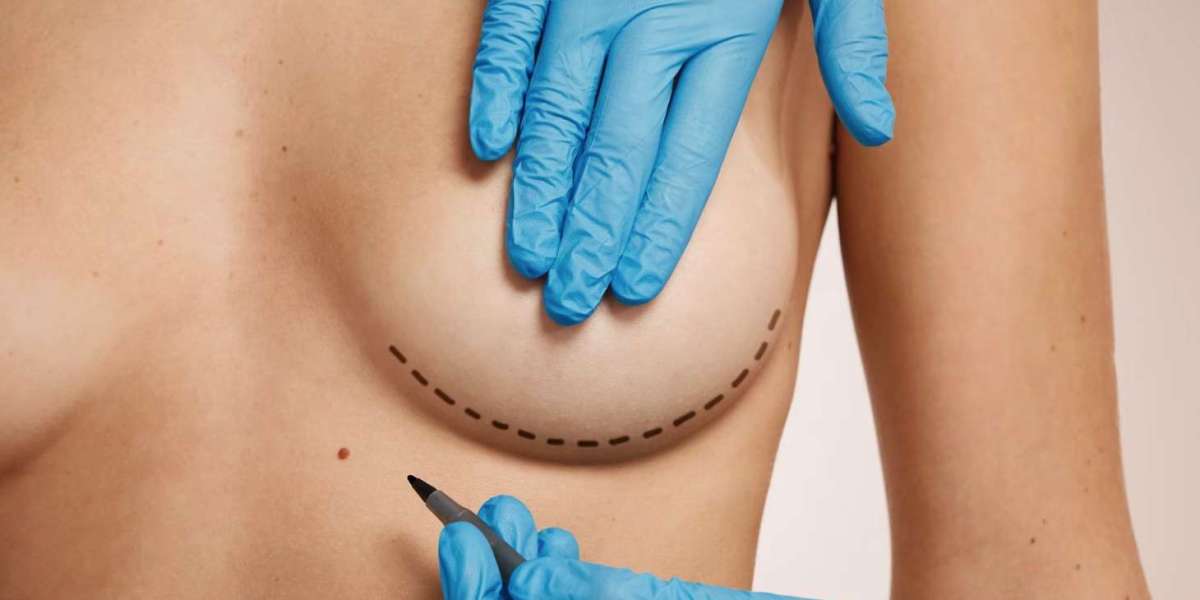 Breast Lift in Dubai for Sagging Breasts: Causes and Solutions