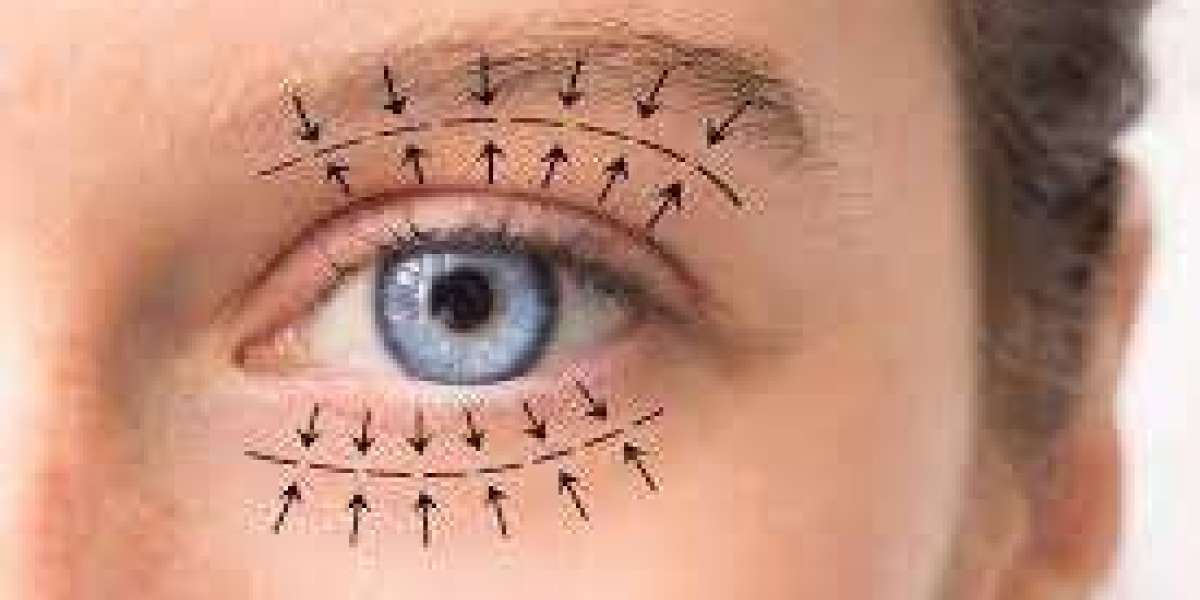 Step-by-Step Guide to Blepharoplasty in Dubai: From Consultation to Recovery