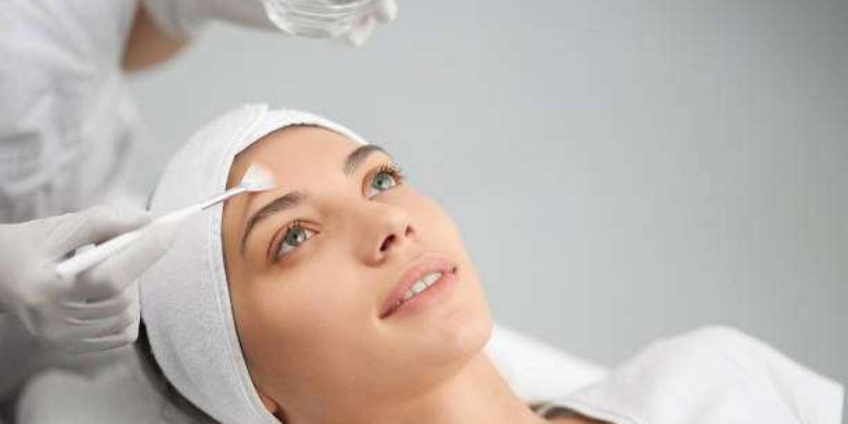 Top Benefits of Glycolic Peel Treatment in Dubai for Glowing Skin