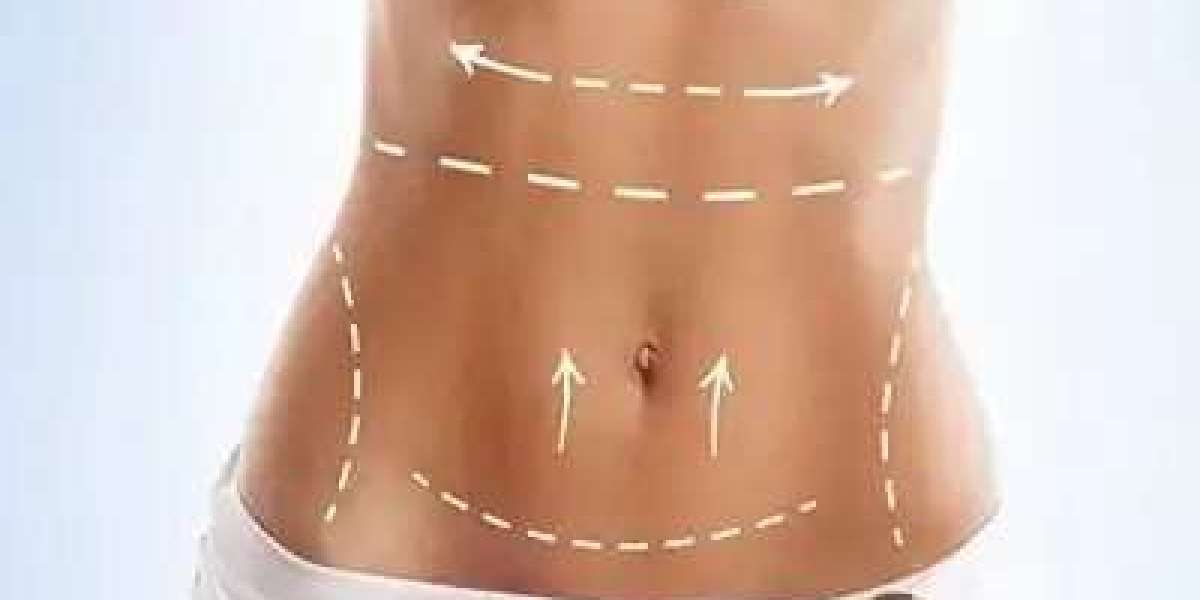 What Makes 360 Body Contouring in Riyadh Different from Other Cities?