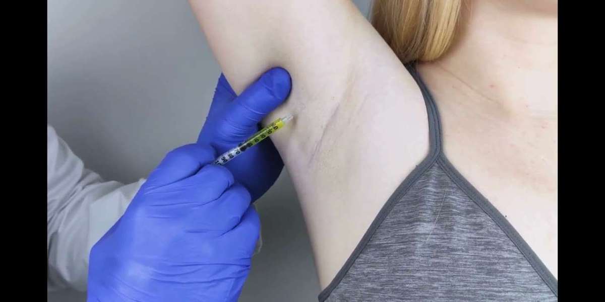 How Botox Stops Sweating in Dubai Explained