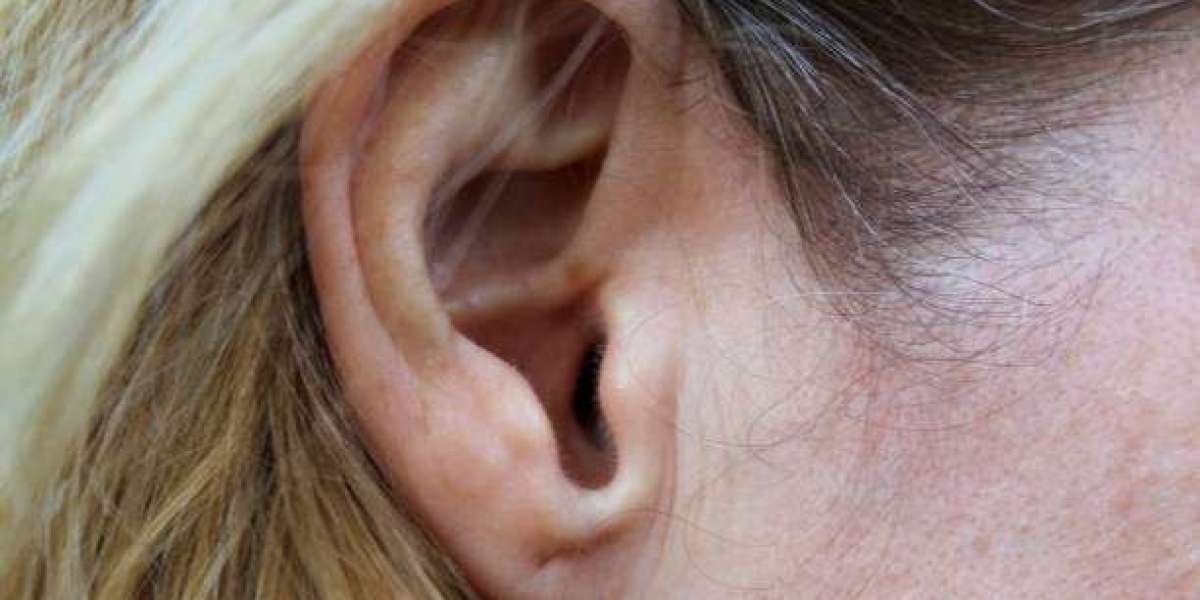 Earlobe Surgery in Dubai Healing Time and Expected Results