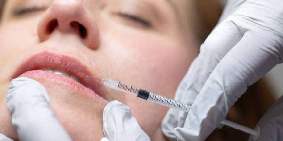 Lip Fillers Injection in Dubai for Aging Lips: Restore Volume