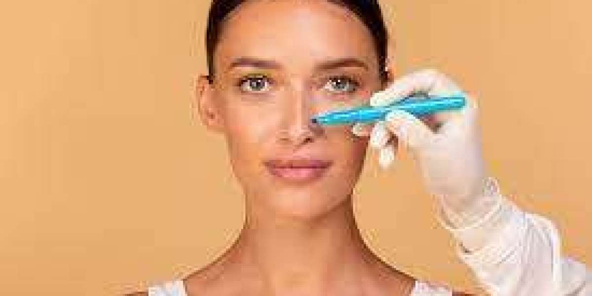 How Rhinoplasty Can Improve Your Facial Proportions Naturally