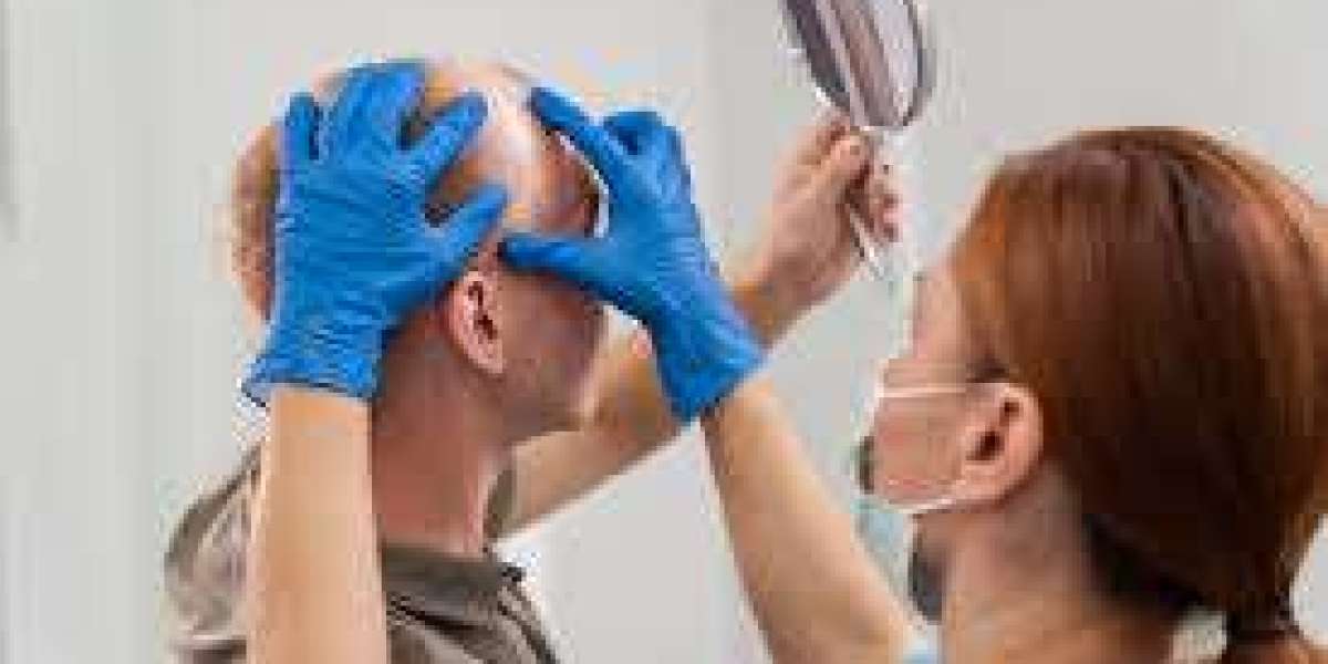 Hair transplant in Dubai Side Effects and Safety