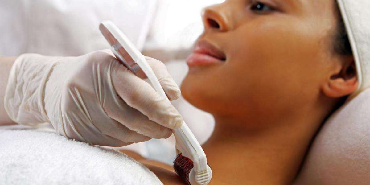 Microneedling Treatment with PRP in Dubai: A Complete Guide