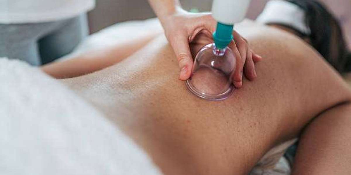 Improving Heart Health & Circulation with Cupping Therapy in Dubai