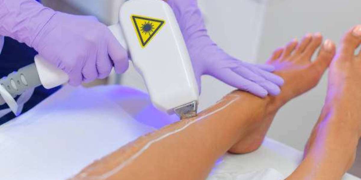 Laser Hair Removal Consultation Questions: What to Ask for Clarity