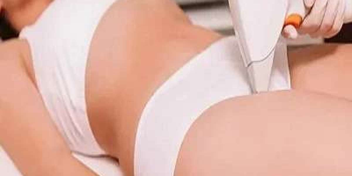 Step-by-Step Process of Vaginal Tightening Laser Treatment in Dubai