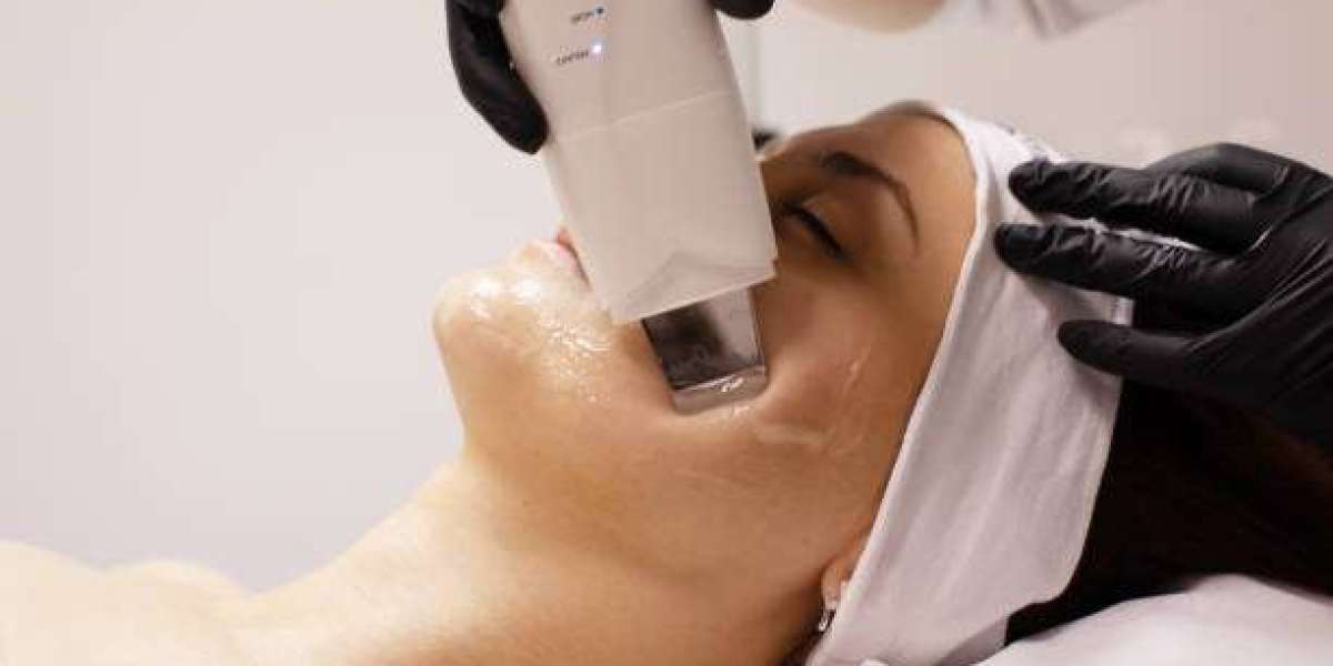 Ultrasonic Skin Peeling in Dubai: Ideal Treatment for Hyperpigmentation?