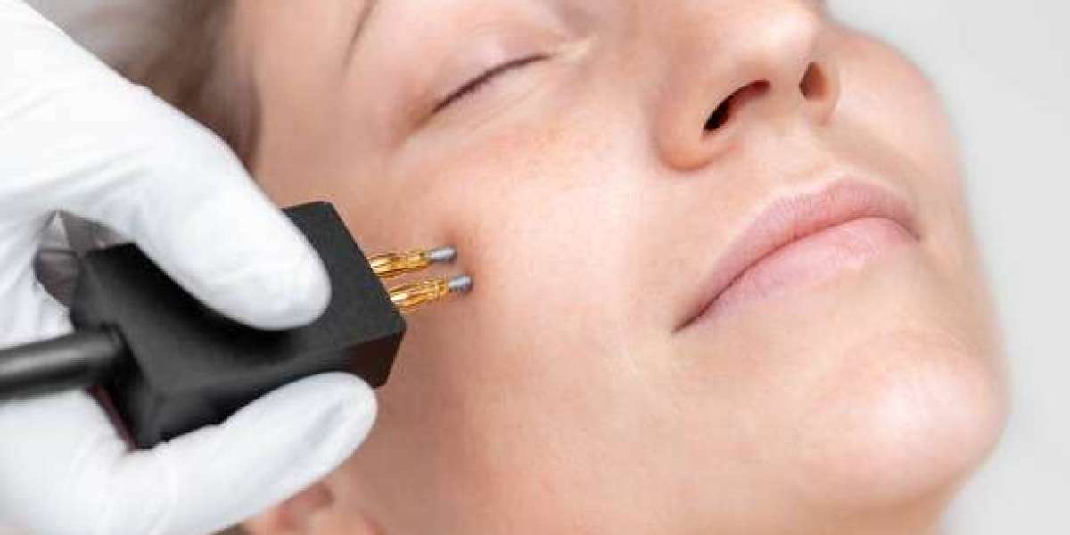 New Fractional Skin Rejuvenation with Fotona Diode in Dubai