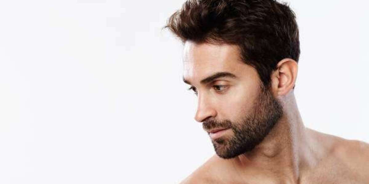 Beard Hair Transplant for Defined and Sharp Beard Lines