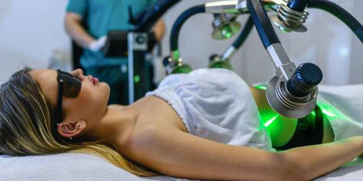Laser Liposuction in Dubai: Benefits, Risks & Suitability Guide