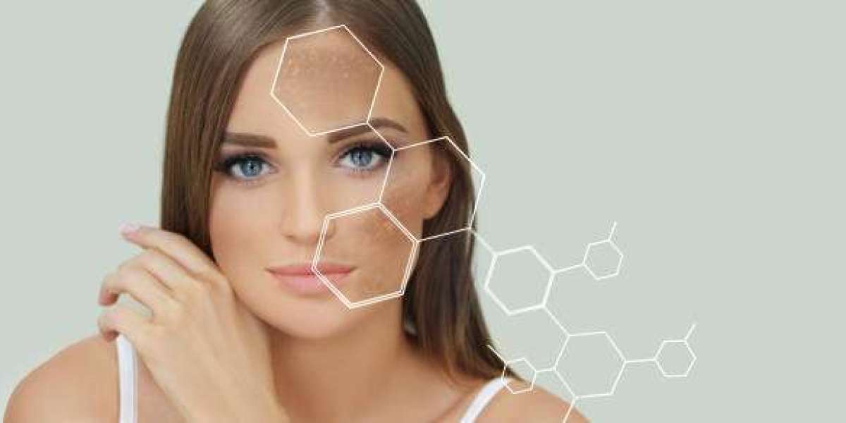Organic Peeling in Dubai for Even Skin Tone: Natural Path to Uniform Complexion