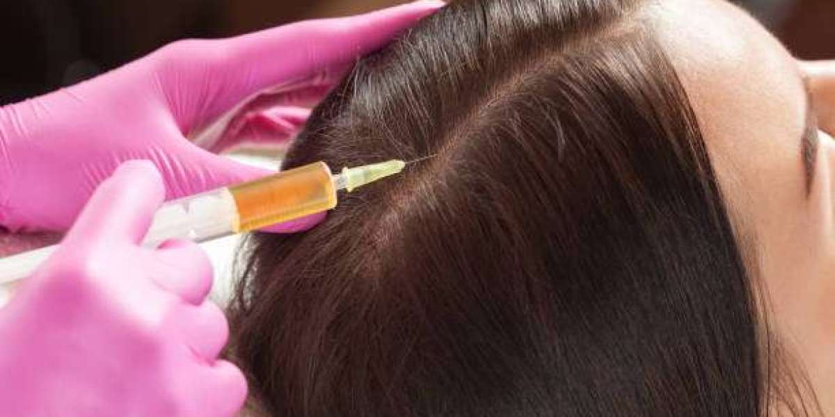 PRP Hair Treatment for Postpartum Hair Loss in Dubai: A Safe Solution