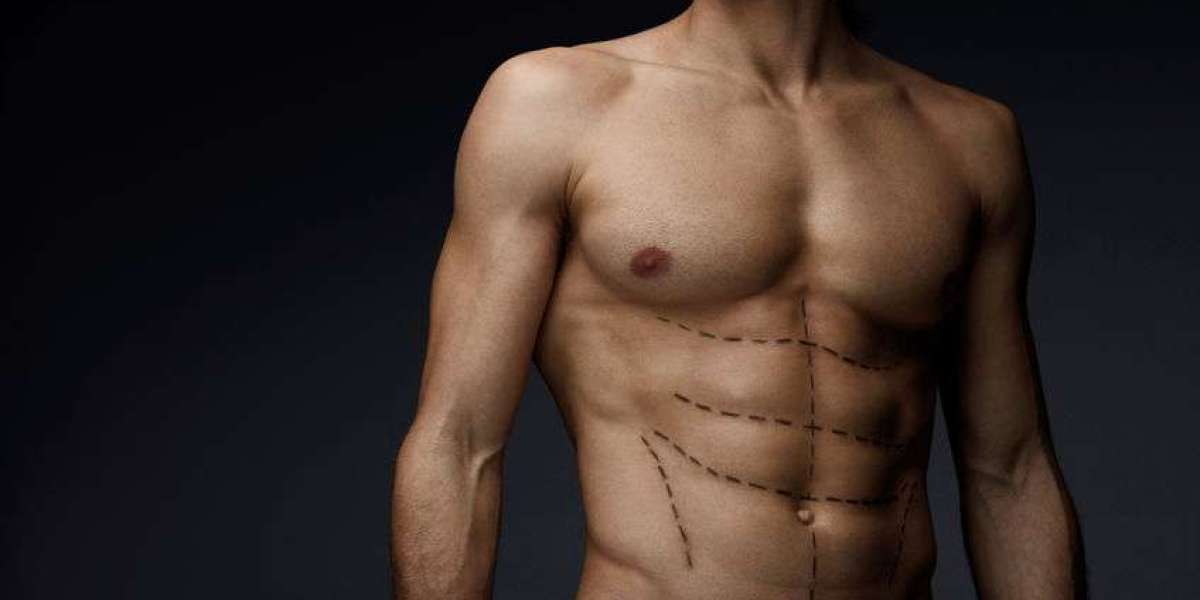 What to Expect Before and After Liposuction Dubai