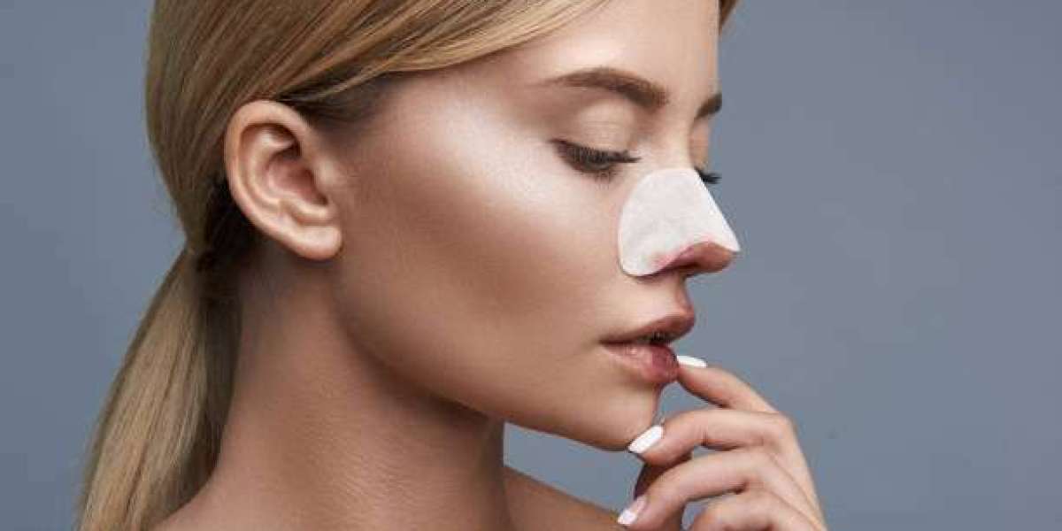 Rhinoplasty for Over-Projected Noses: Bringing Balance Back