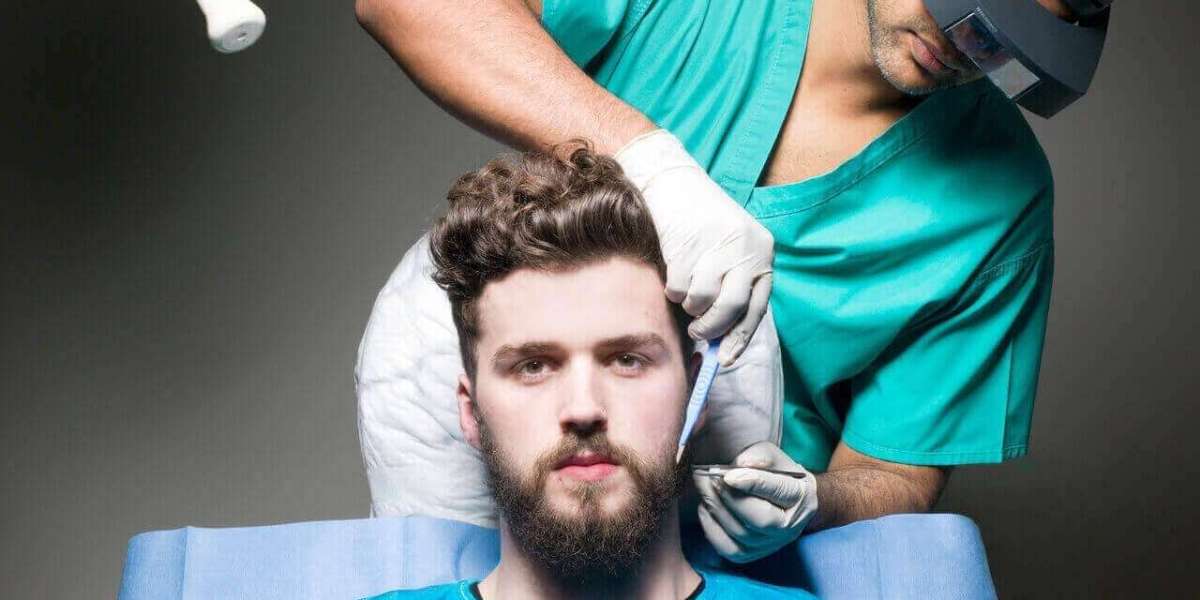 Beard transplant for goatee shaping