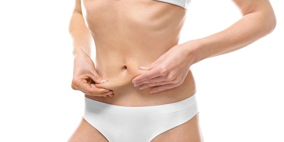 The Benefits of Choosing Liposuction in Dubai Today