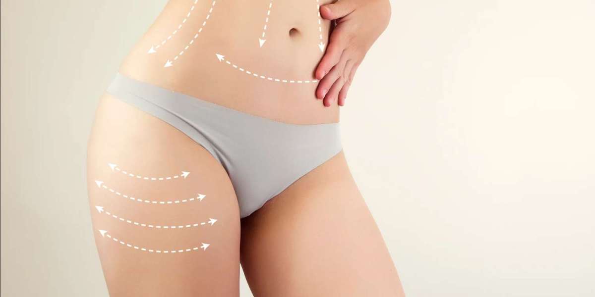 Transform Your Self-Image Liposuction Surgery in Dubai