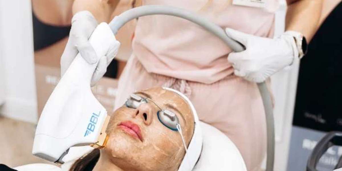 Pigmentation In Manchester – Effective Treatments for Brighter, Even-Toned Skin