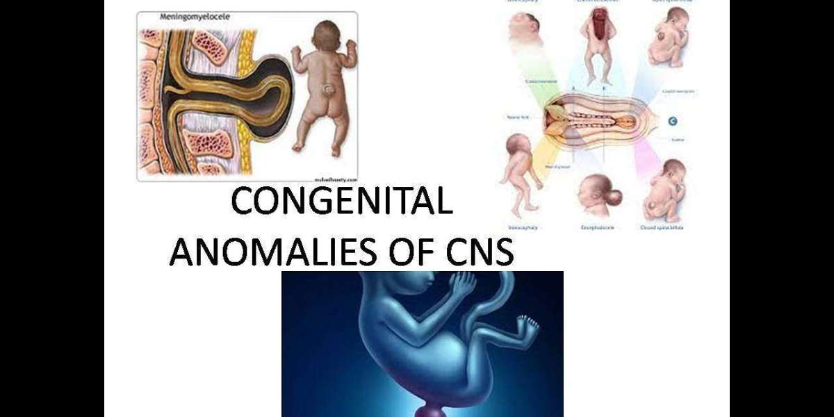 Specialized Care for Pediatric Craniofacial Anomalies in Riyadh