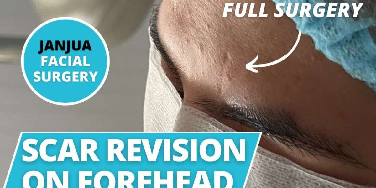 The Importance of Sun Protection Following Scar Revision Procedures