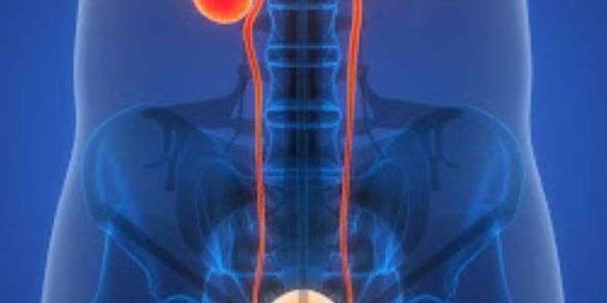 Best Urologist in Jaipur