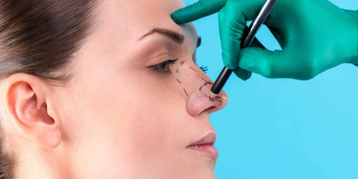 Preparing for surgery mentally and physically