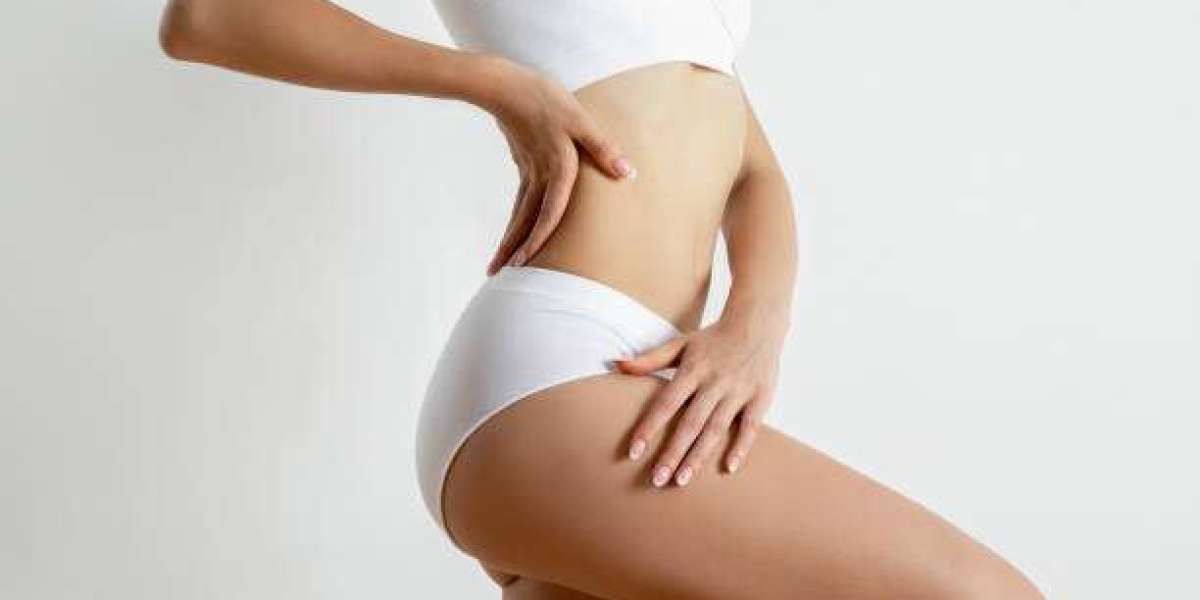 How Liposuction Can Complement Your Fitness Journey in Riyadh