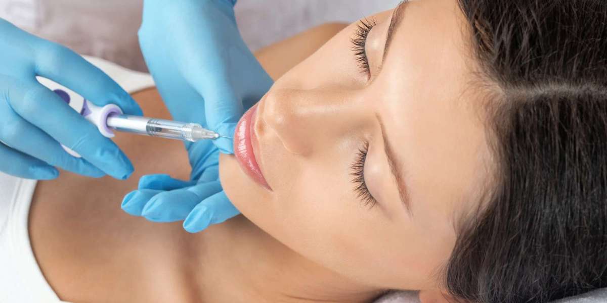 Sculptra Fillers can they create youthful lifted appearance?