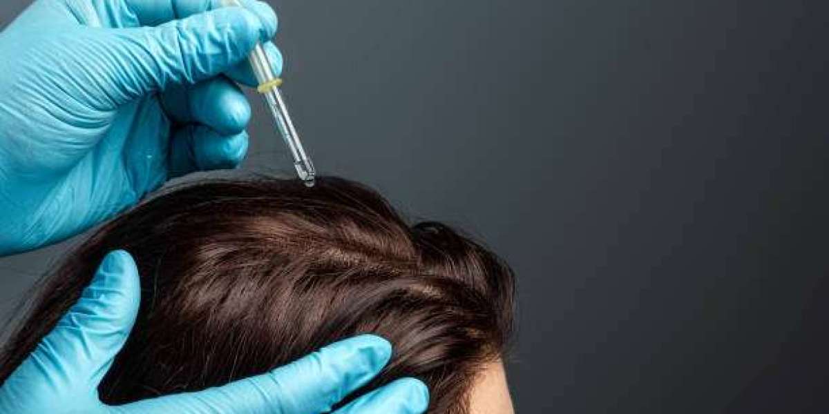 Exosome Hair in Dubai: Nano-Infusion Delivery Methods