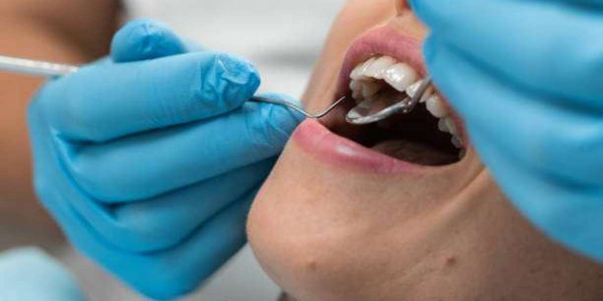 Why Regular Dental Visits Are Essential for Riyadh Residents – Dental Clinic in Riyadh