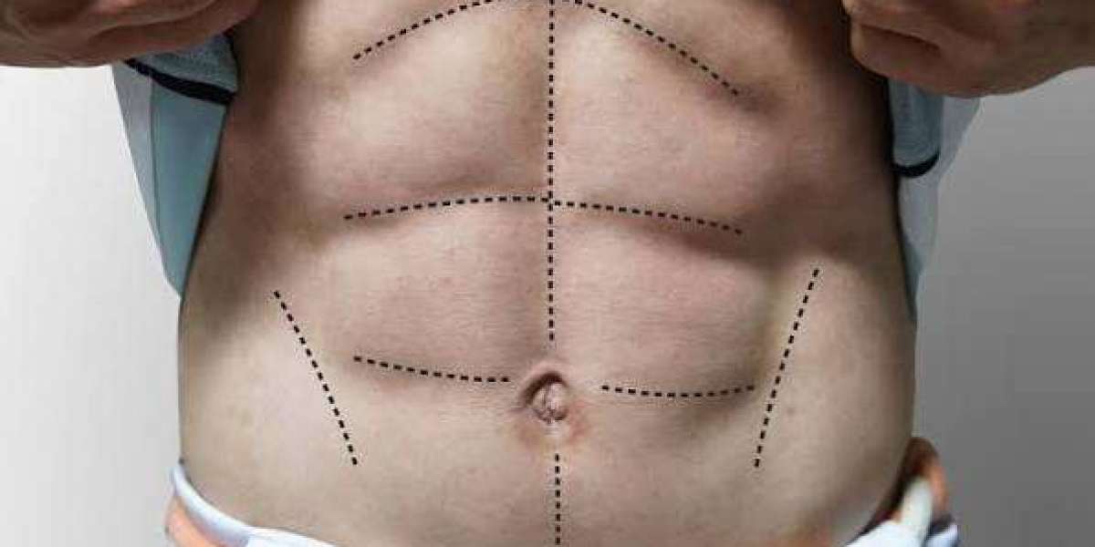 Can Six Pack Abs be achieved with structured fat loss workouts?