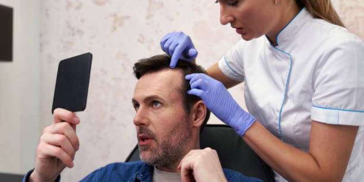 Exploring Non-Surgical Hair Restoration Options in Riyadh