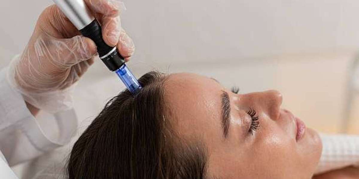 Exploring Exosome Hair in Dubai for Hair Thinning