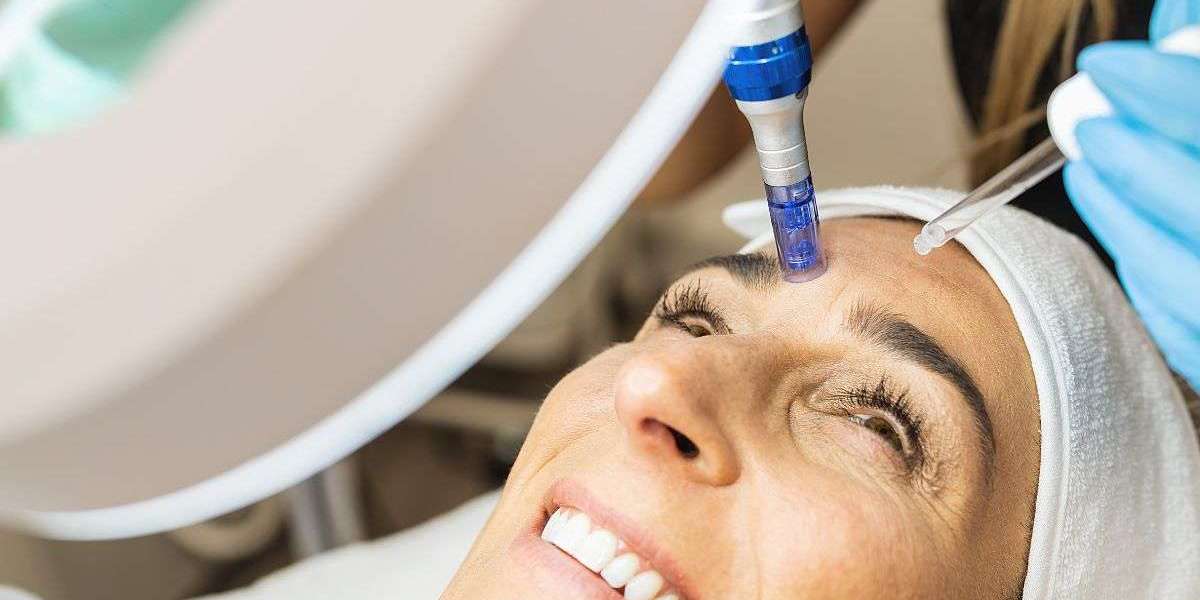 Top 3 Reasons Patients Prefer Enfield Royal Clinic for PRP Skin Rejuvenation