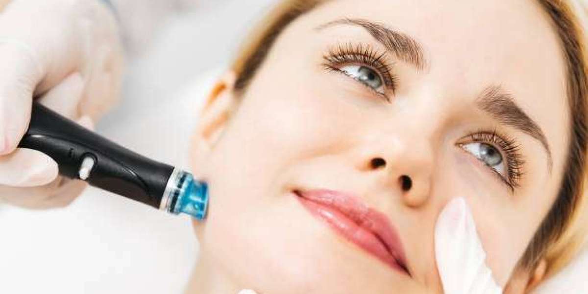 Top Benefits of Hydrafacial for Healthy Skin