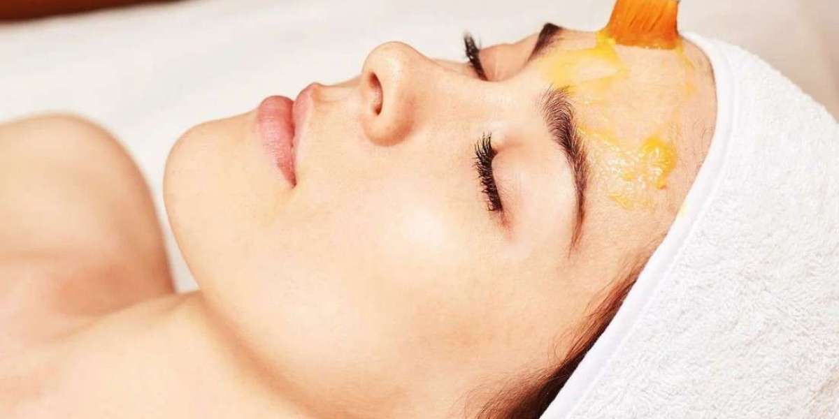 Everything You Need to Know About Chemical Peels in Riyadh