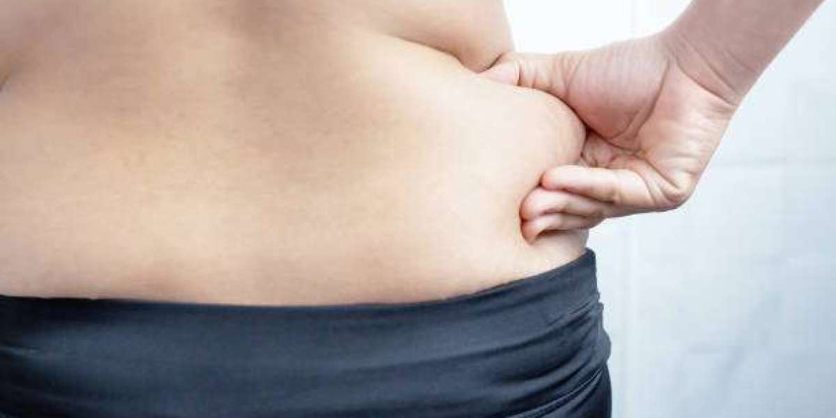 Liposuction Safety and Effectiveness: Insights for Riyadh Patients