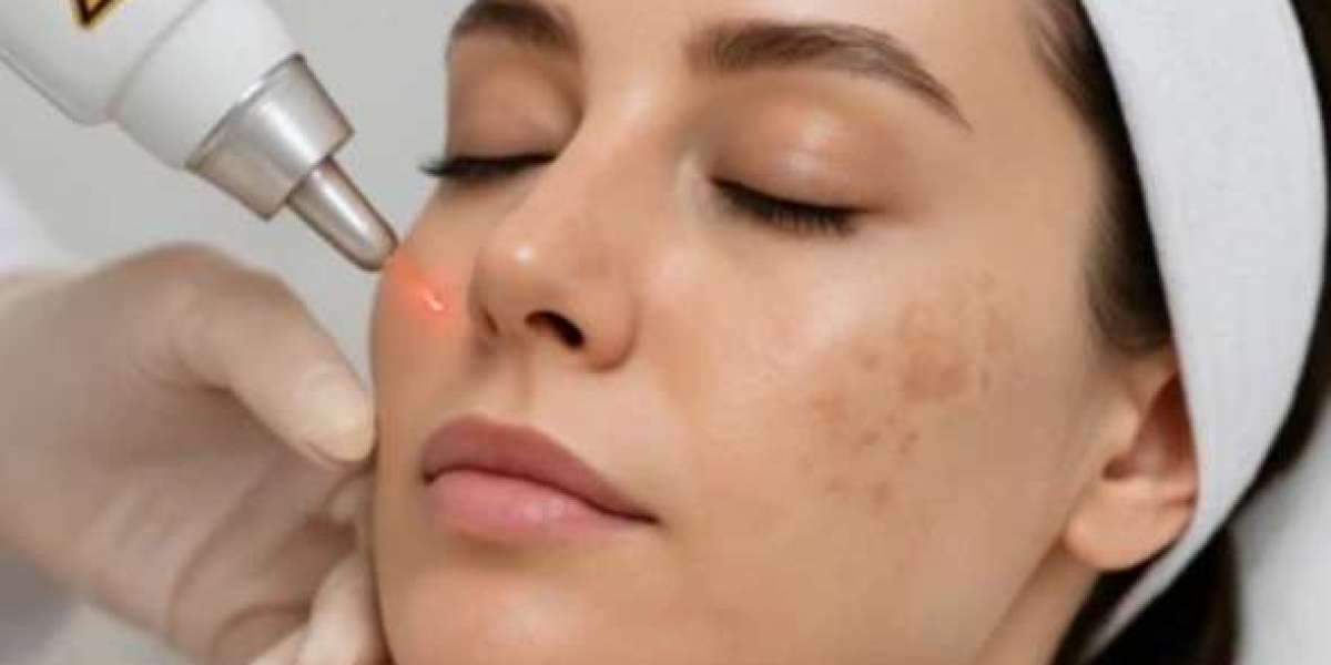 Pigmentation Treatment in Dubai | Restore Even & Radiant Skin Tone