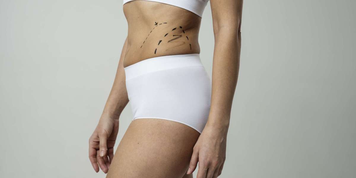 Your Complete Resource for Liposuction Surgery in Dubai