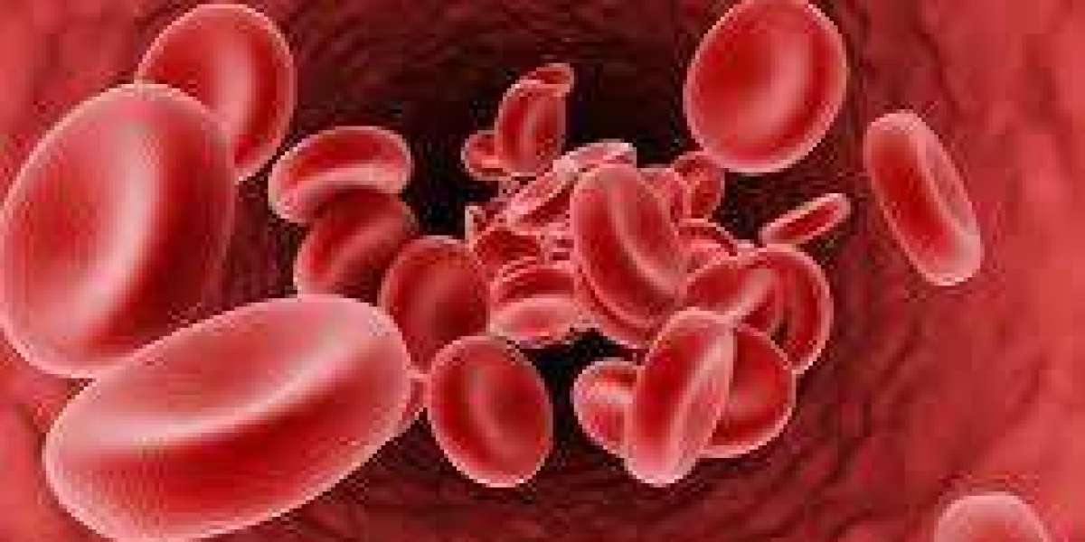 Personalized Anemia Treatment in Dubai for Better Well-Being