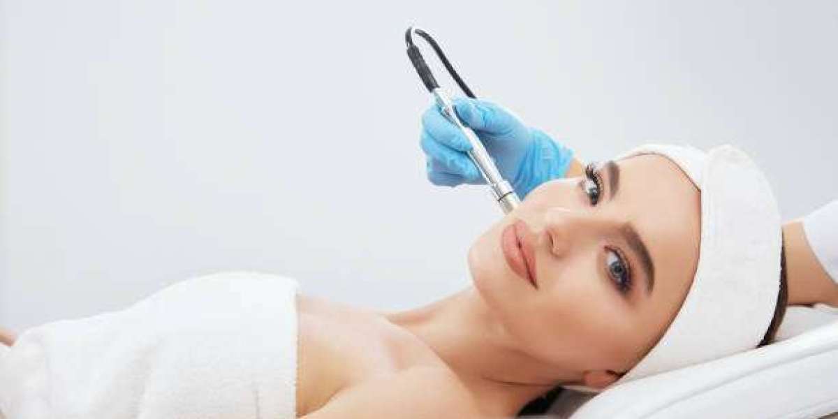 How Long Do Radio Frequency Treatment Results Last?