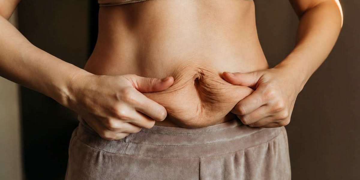 Is Liposuction Surgery in Islamabad Right for Your Body Goals?