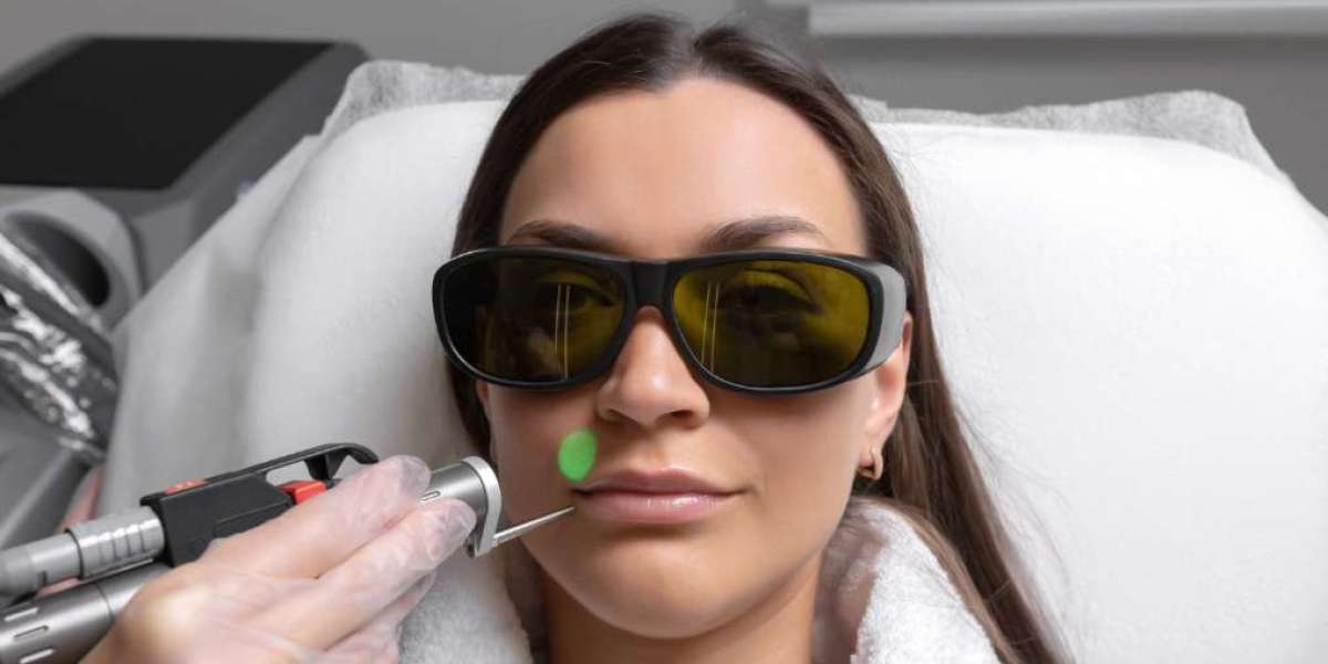 CO2 Laser In Manchester – Advanced Skin Resurfacing for Smoother, Younger-Looking Skin