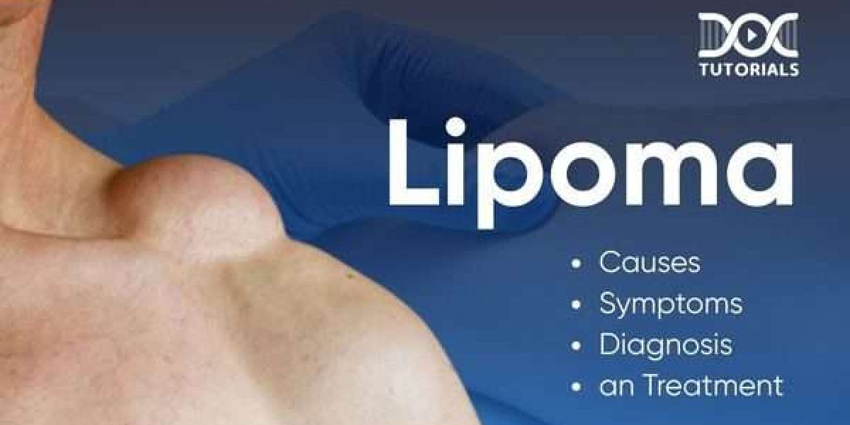 Potential Risks and Complications of Lipoma Removal in Riyadh